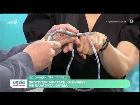 Bypass με Πάλλουσα Καρδιά | Βασίλειος Κωτσής